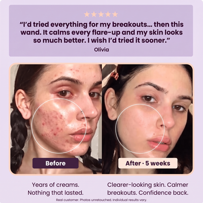 Veyra Essential Wand